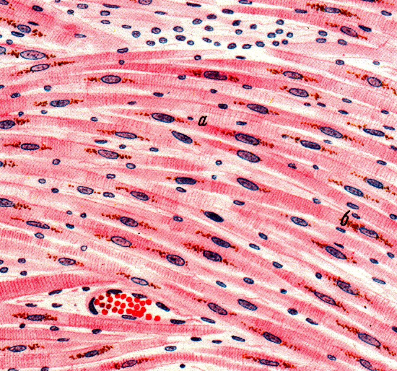 Гладкие мышцы многоядерные. Гладкая мышечная ткань микропрепарат. Гладкомышечная клетка гистология. Бурая атрофия миокарда микропрепарат. Клетки мышечной ткани гистология.
