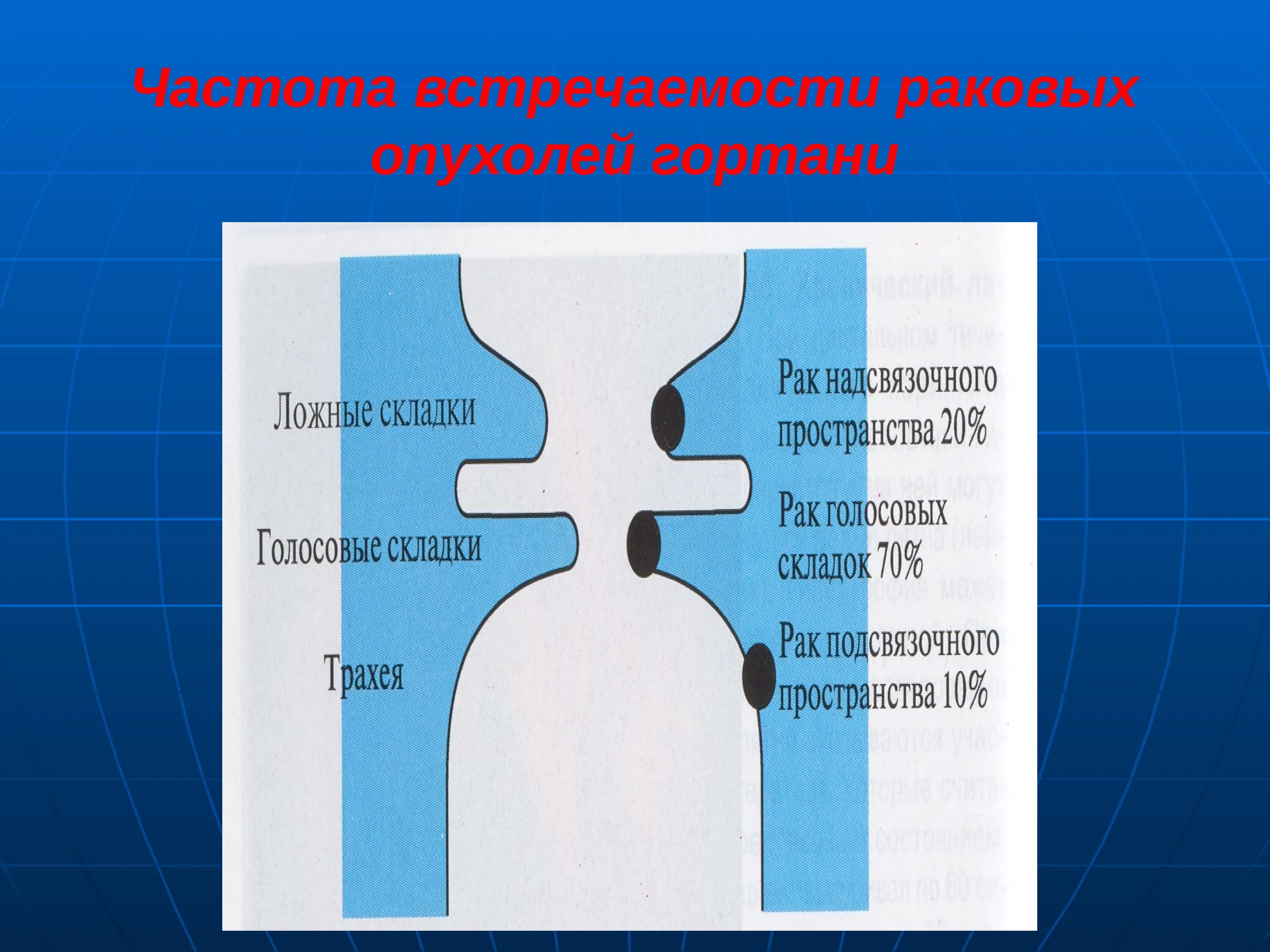 Частота встречаемости рака. Частота встречаемости рака. Гастродуоденит частота встречаемости на 100000. Московский авиационный институт баллы для поступления. Статистика заболевания лейкозом у детей.