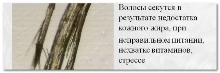 Выпадают волосы секутся. Секутся волосы каких витаминов не хватает. Секущиеся волосы нехватка в организме. Питание волос секущихся. Если секутся волосы какого витамина не хватает.