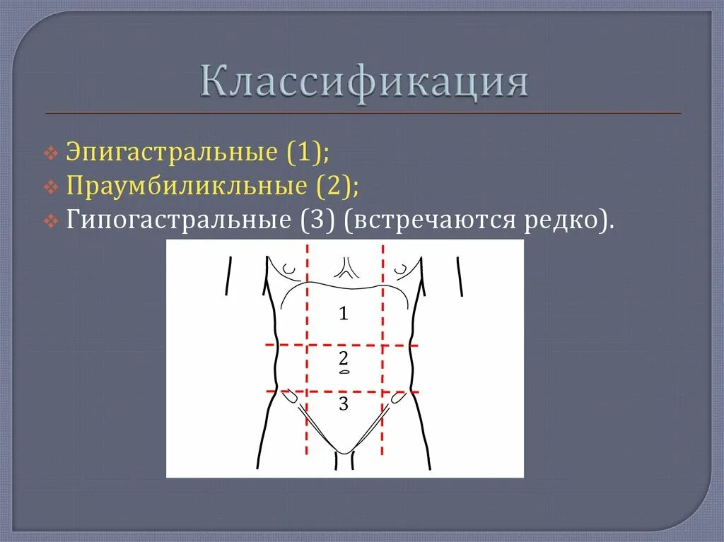 Белая линия живота что это такое. Белая линия живота что это такое