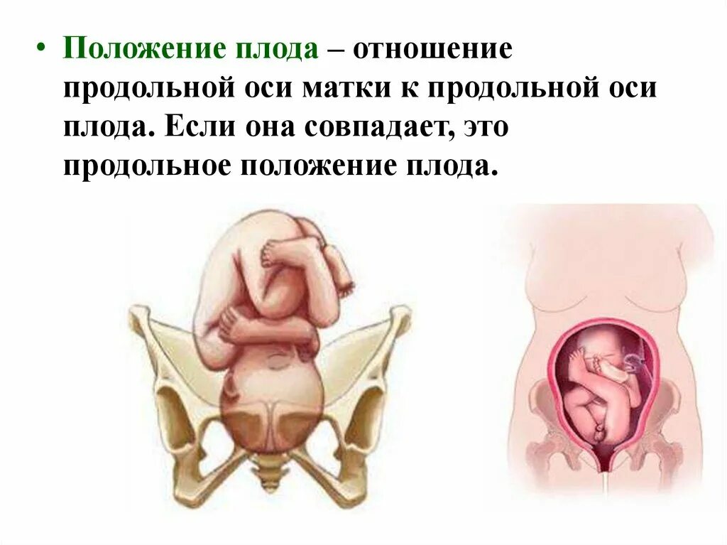 Положение плода в матке продольное. Продольное положение плода. Профильное положение плода. Продольное расположение плода.