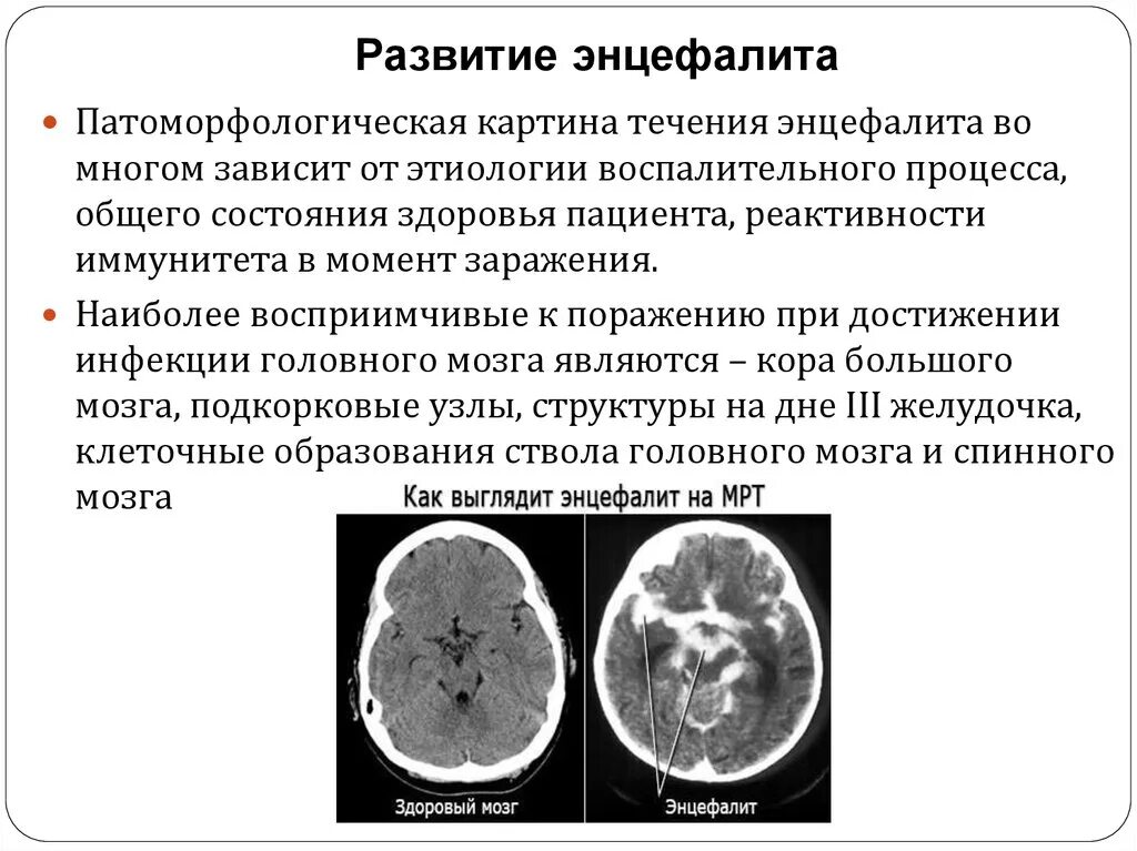 Поражение головного мозга у взрослых. Клещевой энцефалит поражение головного мозга. Герпетический энцефалит кт.