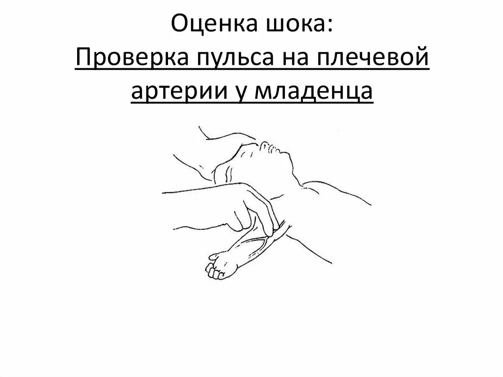 Подсчет пульса у детей. Пальпация пульса на плечевой артерии. Техника измерения пульса у детей. Пальпация пульса на плечевой артерии у детей. Измерение оценка частоты пульса детей.