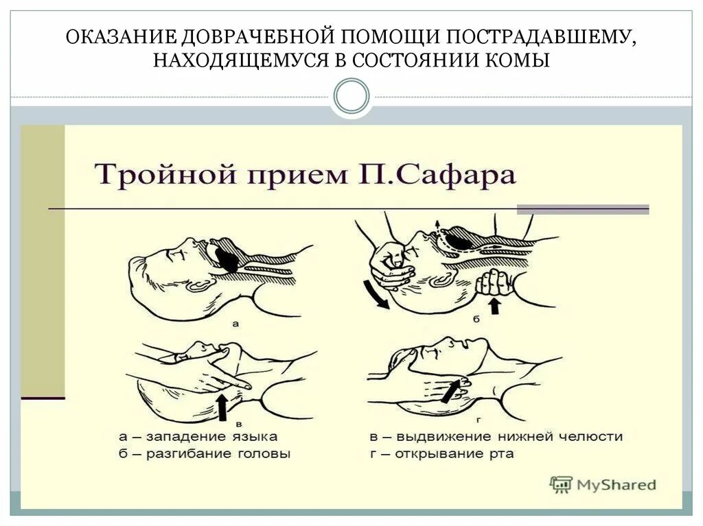 Тройной прием алгоритм. Оказание помощи пострадавшему, находящемуся в состоянии комы.. Доврачебная помощь пострадавшему, находящемуся в состоянии комы.. Оказание первой помощи в состоянии комы. Оказание 1 помощи в состоянии комы.