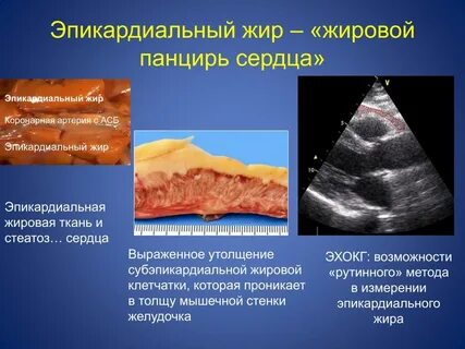 Жировой подвесок