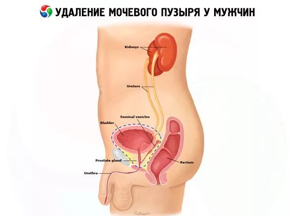 Мочевой у мужчины расположение. Где находится мочевой пузырь. Расположение мочевого пузыря у человека. Мочевой пузырь у женщин. Мочевой пузырь у женщин расположение.