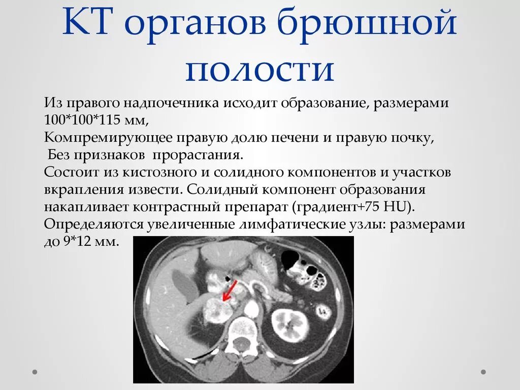 Кт при месячных можно. Кт брюшной полости. Компьютерная томография брюшной. Кт органов брюшной полости. Компьютерная томография органов брюшной полости.