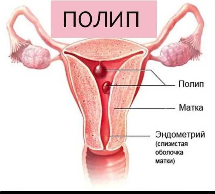 Матку девочка рассказ. Матку девочка рассказ