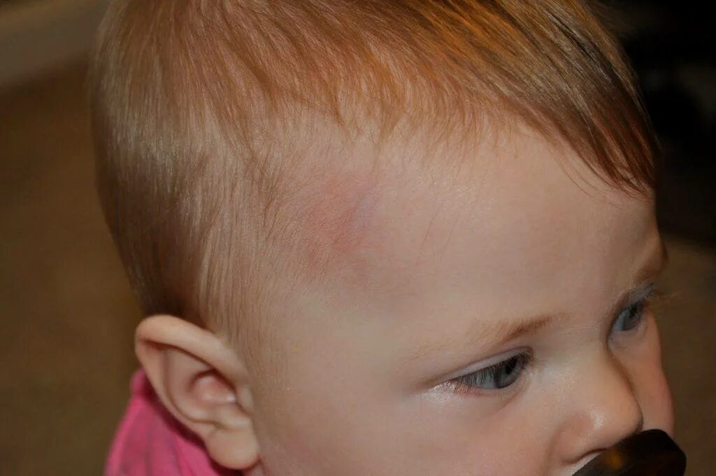 Ребенок часто ударяется головой. Сознание ребенка. Ребёнок в упадке. Ребенок из кроватки. Родничок на лбу у новорожденного.