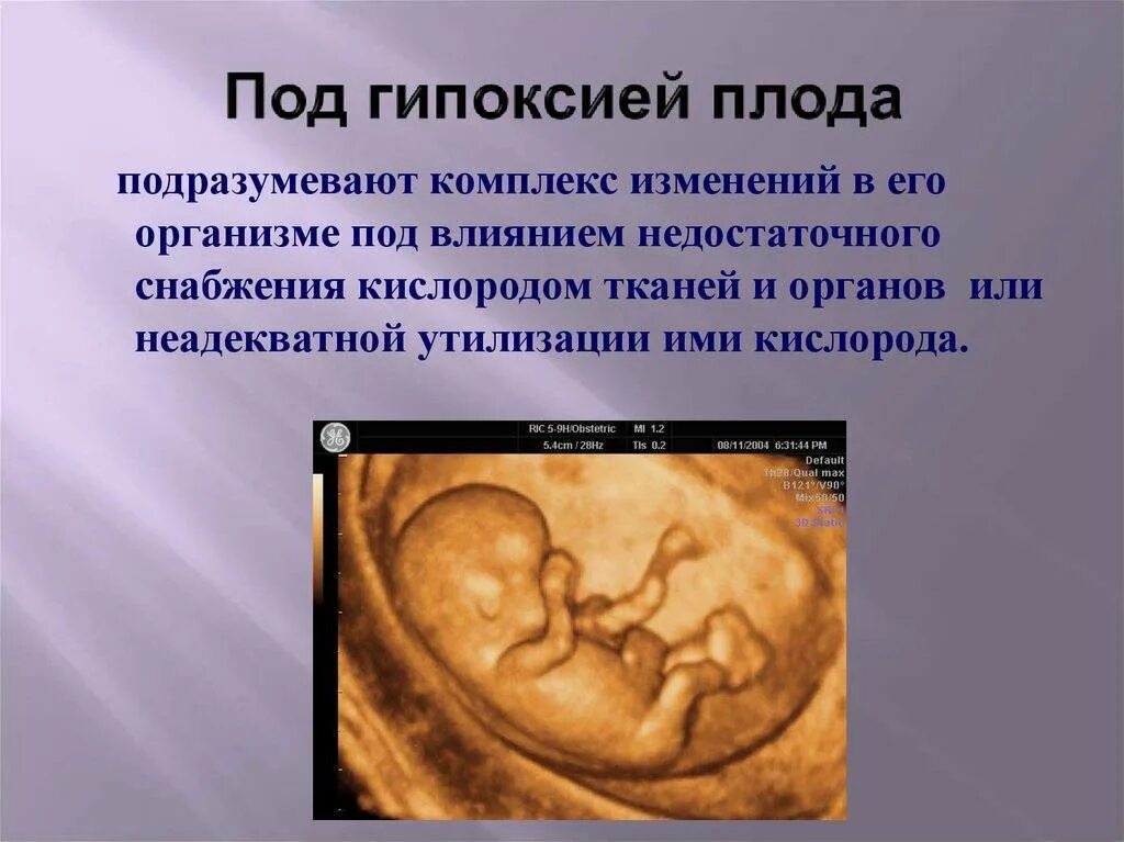 Последствия после гипоксии