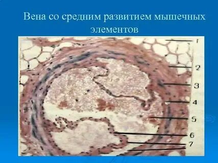 Вена какая ткань