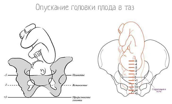 Ребенок опустился в таз. Головка ребенка опустилась в таз. Опускание головки плода. Ребенок опустился в малый таз. 39 недель головка