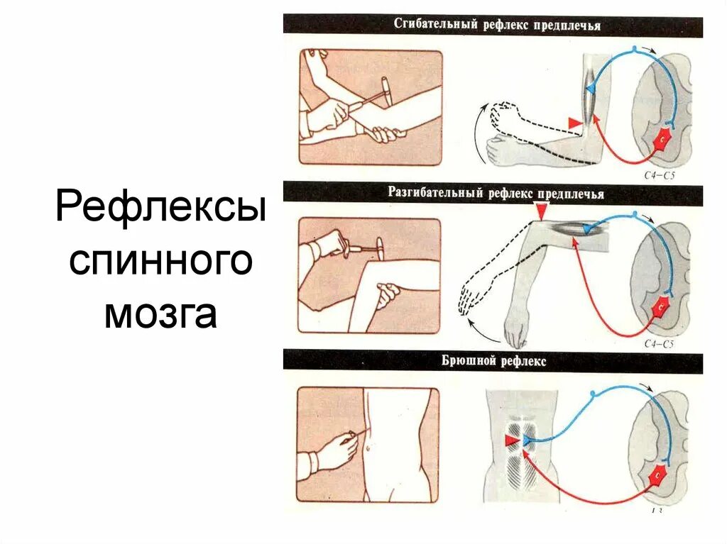 Локтевой сгибательный рефлекс физиология. Рефлекс локтевого сгибателя. Схема дуги сгибательно-локтевой рефлекс,. Локтевой разгибательный рефлекс физиология. Рефлексы замыкаются