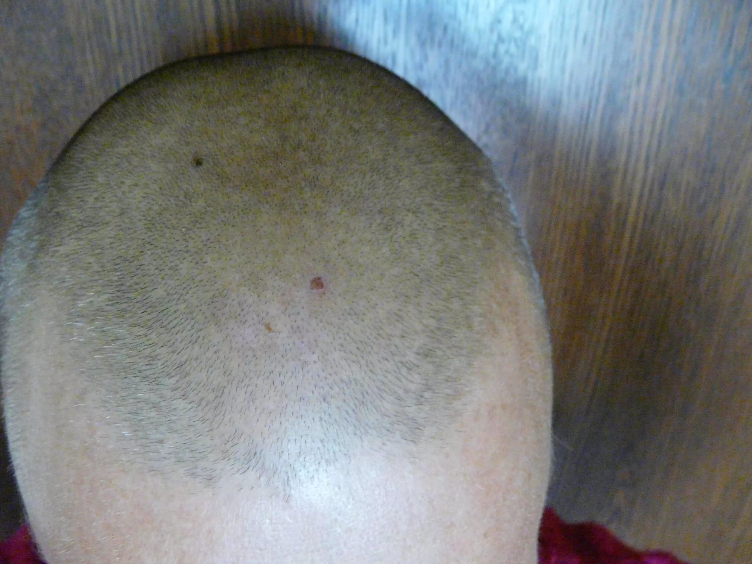 Вши налысо. Короткие стрижки для девочек после вшей. Детская прическа мальчику 6 лет. Фильм с натали портман бреют налысо. Стрижки головы наголо.