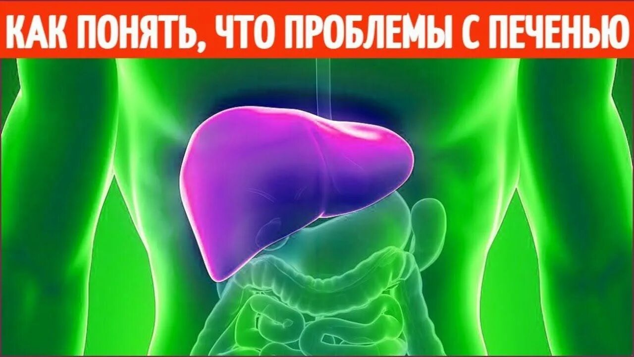 Как понять что с печенью. Как понять что проблемы с печенью. Признаки проблем с печенью. Симптомы неполадок с печенью.