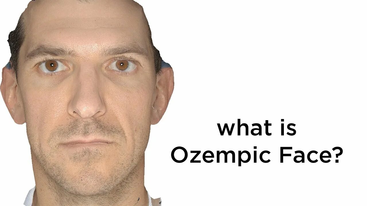 What to know about 'Ozempic face' as some users claim popular diabetes drugs use