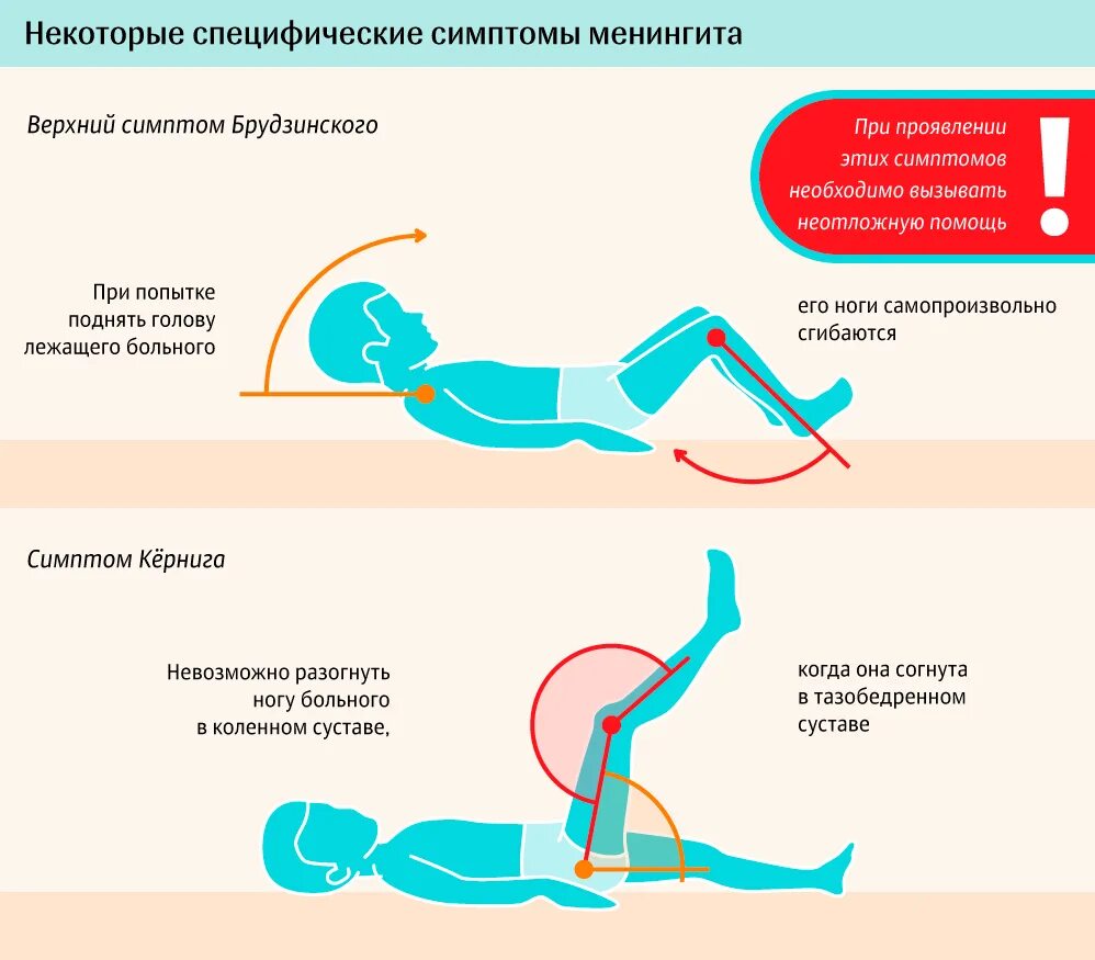 Как выглядит менингит у ребенка Консультация для педагогов и родителей Чем опасны последствия менингита у дете
