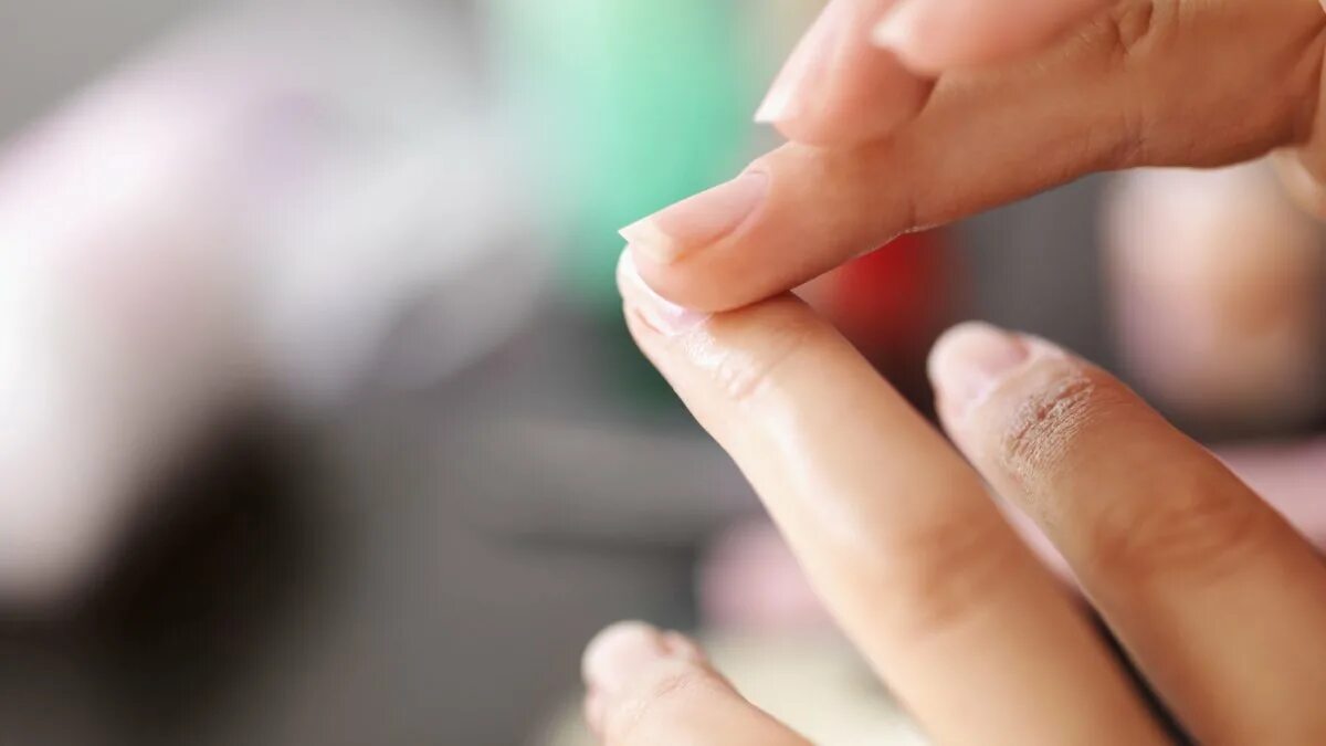 Отходит кожа на руках. Травматичный онихолизис. Трещины на указательном пальце. Дефицит витаминов по коже ладони. Отходит кожа на руках.