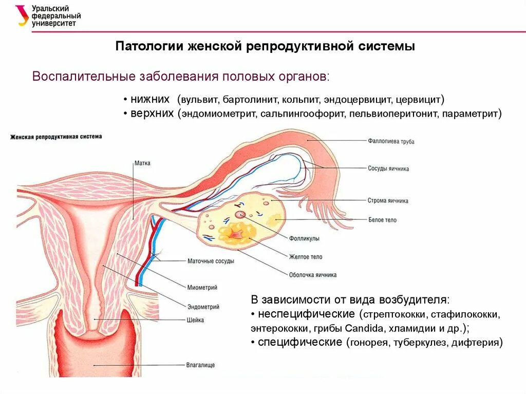 Репродуктивная женская половая система. Патологии женской репродуктивной системы. Воспаление репродуктивной системы. Воспаление женской половой системы. Болезни репродуктивных органов.