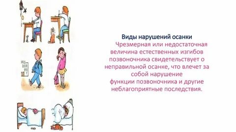 Что не является причиной нарушения осанки