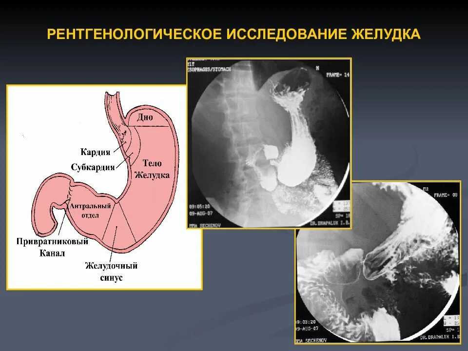 Исследования пищевода и желудка