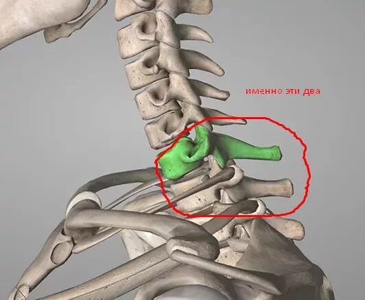 Выпирает шейный позвонок. Почему кости торчат
