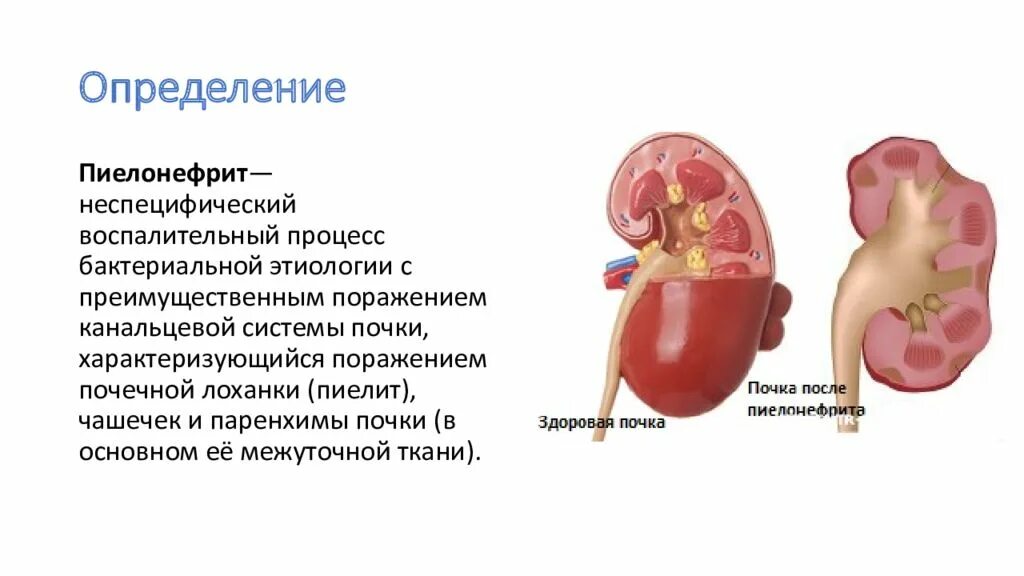 Пиелонефрита преимущественное поражение почек. Пиелонефрит картинки для презентации. Здоровая почка и пиелонефрит.