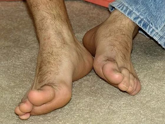 Hairy foot. Потные ноги male feet.