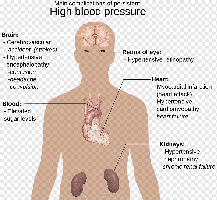 Симптомы повышено давления. Симптомы повышенного давления. Признаки давления. Повышенное давление симптомы. Органы мишени артериальной гипертонии.
