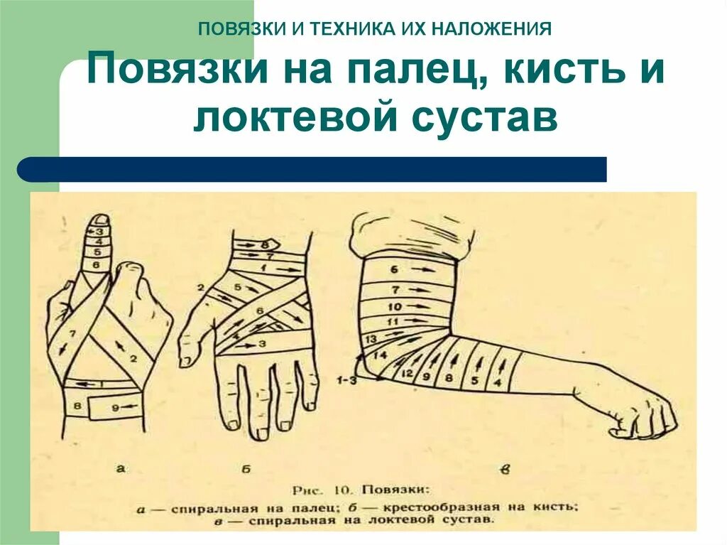 Техника наложения различных повязок. Правила наложения бинтовых повязок на локоть. Схемы наложения повязок. Спиральная повязка на локоть. Десмургия повязки.