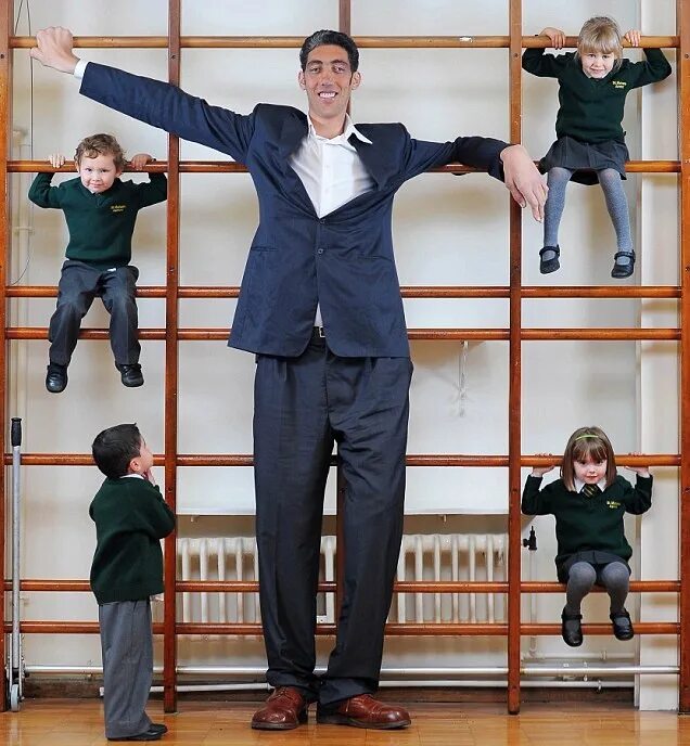 Низкий рост. Высокие женщины. Гипофизарный гигантизм. Селина свифт. Уильям джевелл.