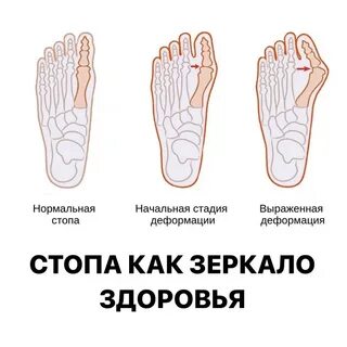 Основание стопы