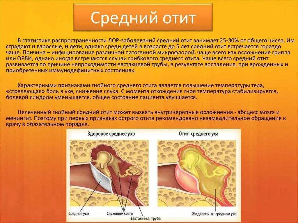 Внутреннее ухо лечение и симптомы. Острый Гнойный средний отит профилактика. Средний и наружный отит симптомы. Средний Гнойный отит у детей клинические рекомендации. Наружный средний Гнойный отит.