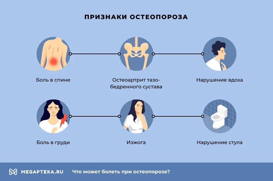 Симптомы остеопороза у женщин после 50 лет. Остеопороз симптомы. Признаки остеопороза. Клинические проявления остеопороза. Клинические симптомы остеопороза.