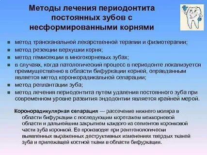 Методы лечения зуба