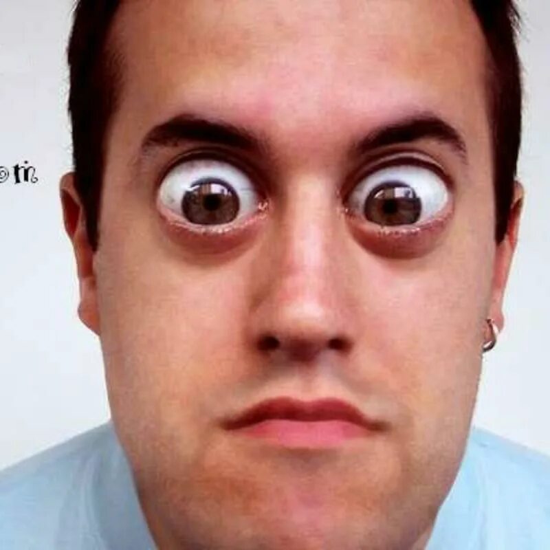 Широко открытые глаза. Глаза стали удивленными. Грибковыепорадения глаз. Удивленный взгляд человека. Удивленные глаза девушки.