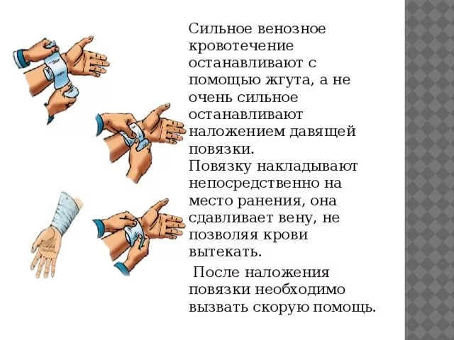 Способы наложения повязок при кровотечении. Давящую повязку для остановки кровотечения накладывают. Жгут используется для остановки венозного кровотечения.. Метод остановки венозного кровотечения (2 правильных ответа):. Наложение давящей повязки при венозном кровотечении.