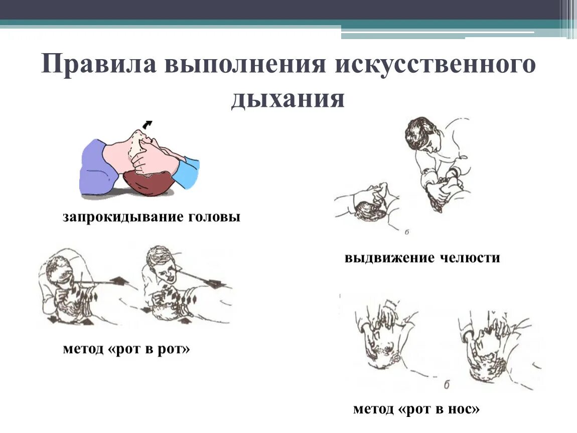 Правила выполнения искусственного дыхания. Правильность выполнения искусственного дыхания. Способы выполнения искусственного дыхания. Способы и порядок проведения искусственного дыхания.