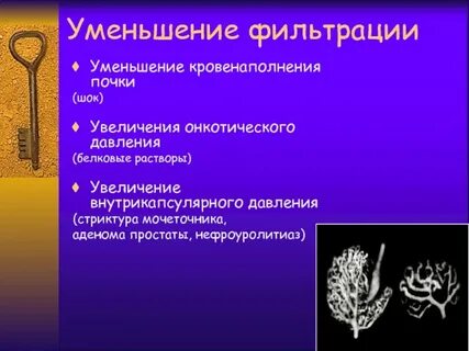Нефроуролитиаз