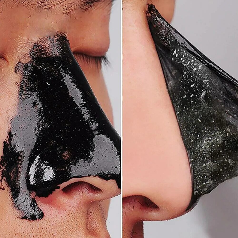 Черная маска для носа