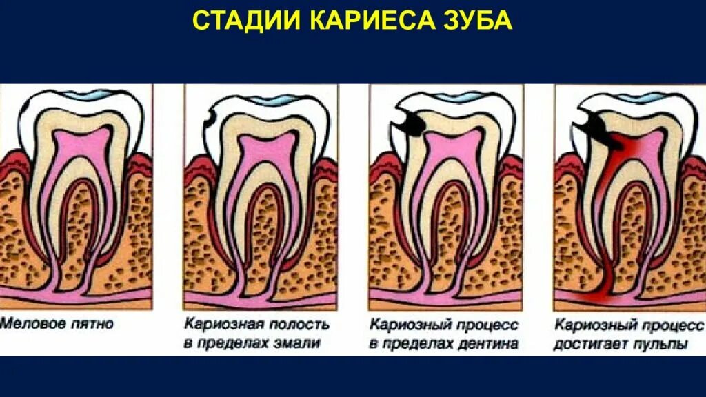 Рокс периодонт
