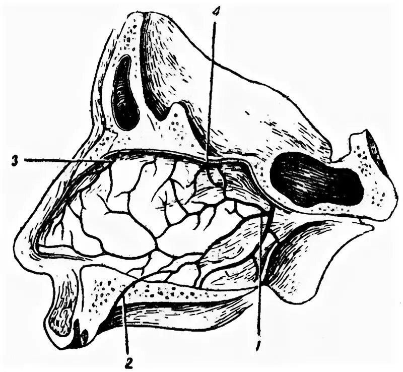 перелом решетчатой кости