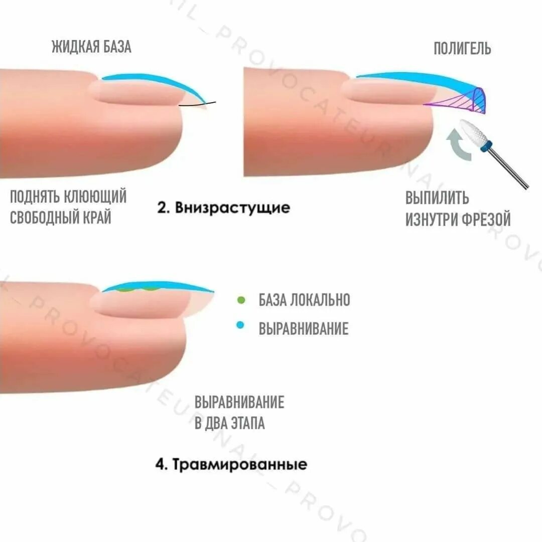 Наносить нужно в 2. Правильная форма ногтя вид сбоку. Схема выравнивания ногтевой пластины гелем. Правильная форма нарощенных ногтей вид сбоку. Выравнивание ногтей сбоку.