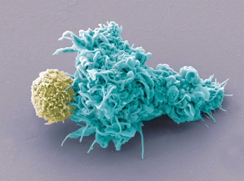 Вакцина дендритными клетками. Дендритные клетки электронная микроскопия. Т лимфоциты под микроскопом. Дендритные клетки в микроскопе. Макрофаги и дендритные клетки.