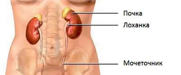 Локализация почечных болей. Болит почка с левой стороны. Болят почки симптомы. Локализация боли в почках.