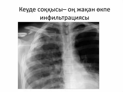 Орыс театр және кино актрисаларының жалаңаш бейнелері