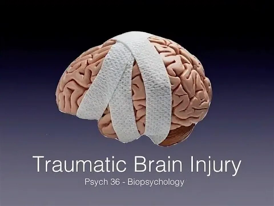 Traumatic brain. TBI.