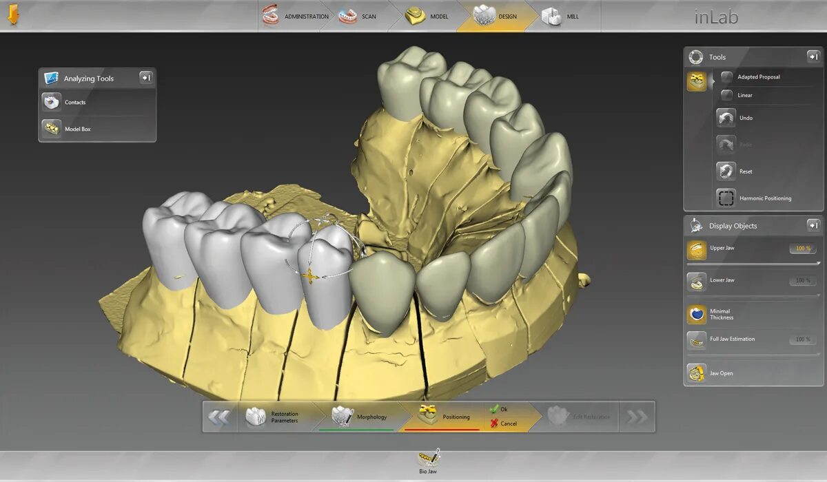 Cad cam моделирование. Кад кам технологии в стоматологии. cad cam системы в стоматологии. cad cam сканирование. моделирование коронки cad cam.