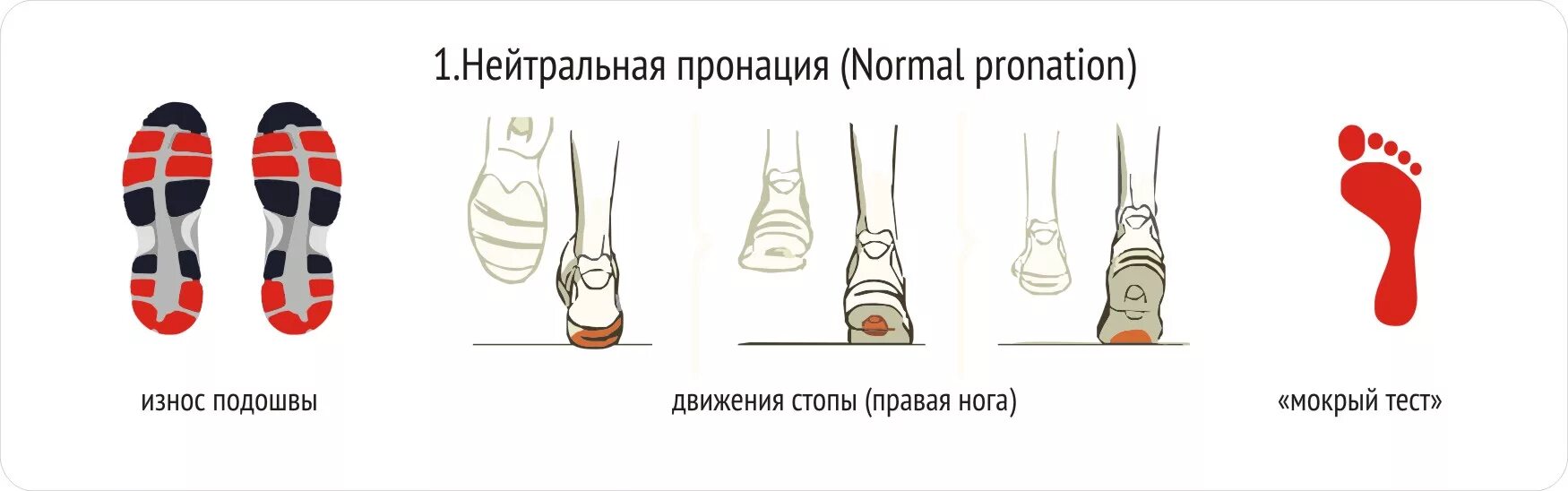 Пронация гиперпронация кроссовки. Пронация среднего отдела стопы. Тип пронации нейтральная пронация что это. Плоскостопие пронация стопы. Кроссовки с гиперпронацией