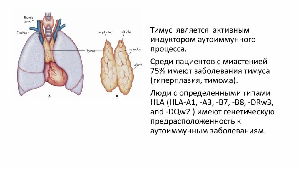 Миастения вилочковая железа. Миастения. Миастения вилочковой железы. Миастении патоморфология. Миастения патогенез.